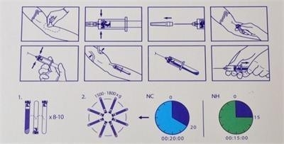 Appareil de centrifugeuse portable PRP de 6/8x15 ml 0-4000 tr/min Pour les hôpitaux de chirurgie esthétique