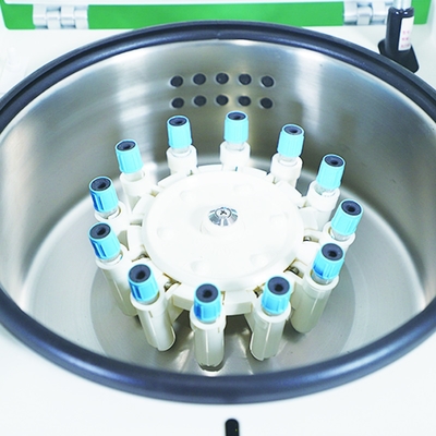 Test du sang rouge à la machine de lavage de cellules multifonctionnelle